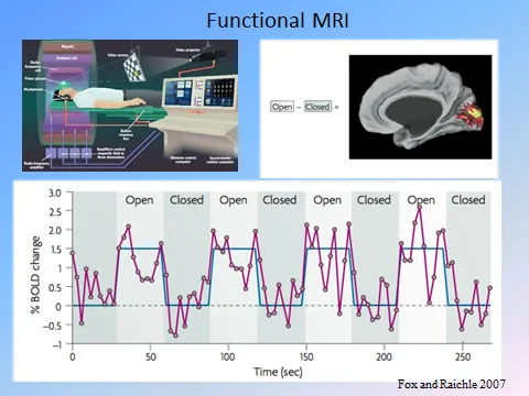 FUNCTIONAL MRI